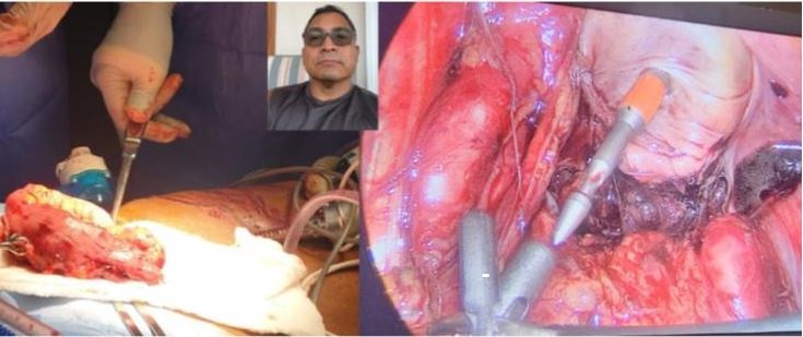 Remote Mentor Assistance